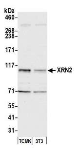 XRN2 Antibody - Detection of mouse XRN2 by western blot. Samples: Whole cell lysate (15 µg) from TCMK-1 and NIH 3T3 cells prepared using NETN lysis buffer. Antibody: Affinity purified rabbit anti-XRN2 antibody used for WB at 0.1 µg/ml. Detection: Chemiluminescence with an exposure time of 10 seconds.