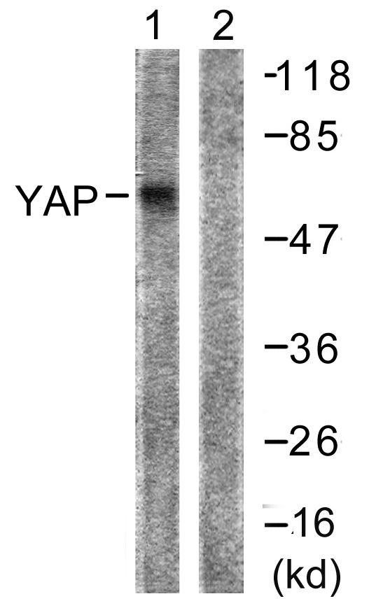 YAP / YAP1 Antibody - Western blot analysis of lysates from HepG2 cells, treated with Wortmannin 40nM 24h, using YAP Antibody. The lane on the right is blocked with the synthesized peptide.