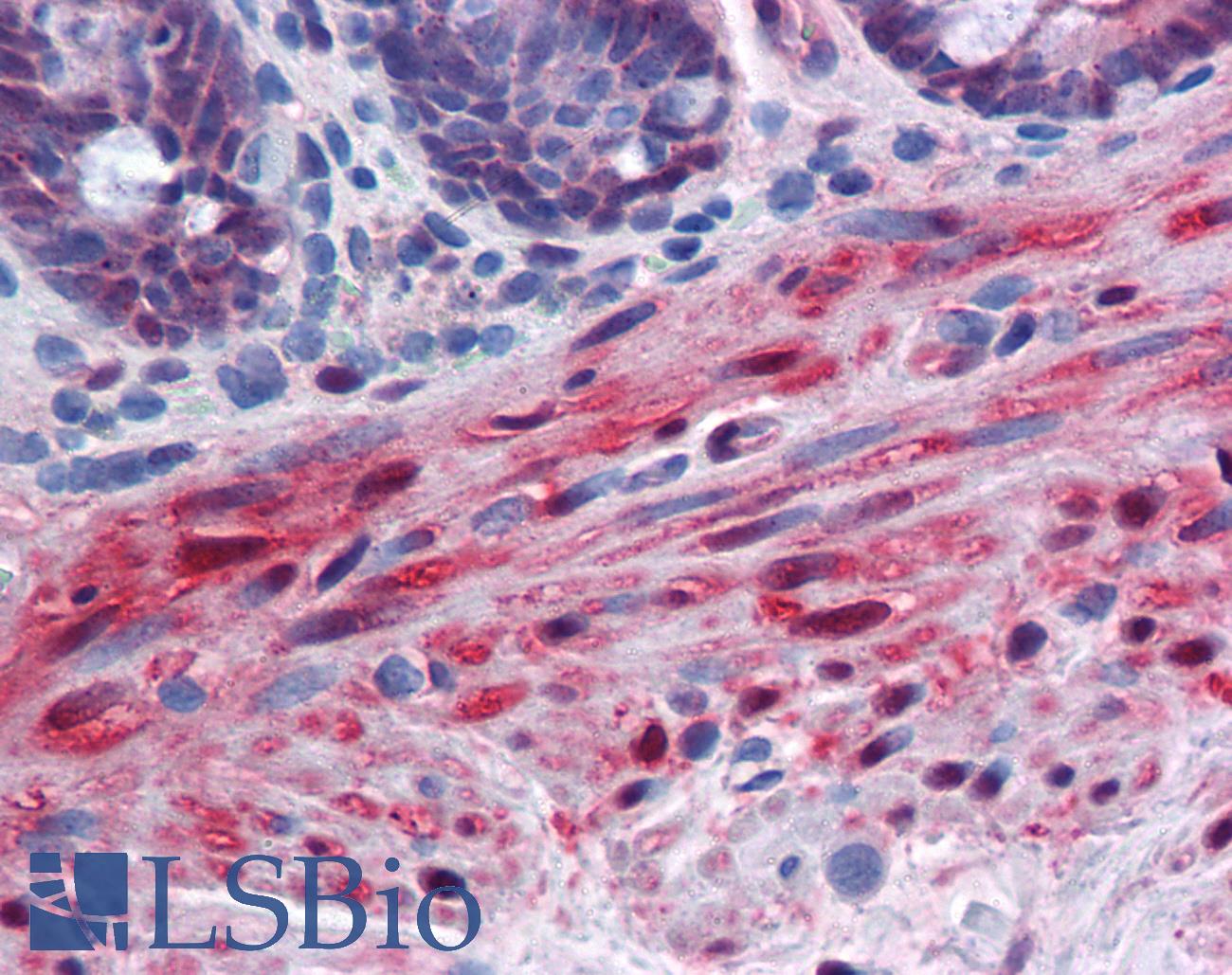 YAP / YAP1 Antibody - Anti-YAP1 antibody IHC of human colon, muscularis mucosa. Immunohistochemistry of formalin-fixed, paraffin-embedded tissue after heat-induced antigen retrieval. Antibody concentration 5 ug/ml.