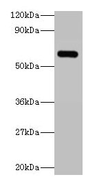 YARS / Tyrosyl-tRNA Synthetase Antibody - Western blot All lanes: Tyrosyl-tRNA synthetase, cytoplasmic antibody at 2µg/ml + 293T whole cell lysate Secondary Goat polyclonal to rabbit IgG at 1/15000 dilution Predicted band size: 58 kDa Observed band size: 58 kDa