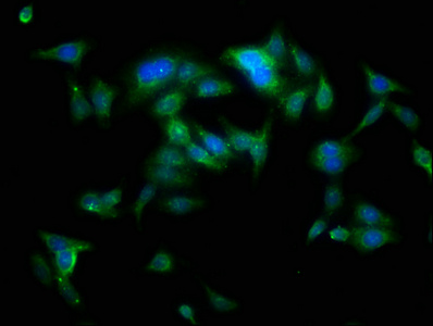 YARS / Tyrosyl-tRNA Synthetase Antibody - Immunofluorescence staining of HepG2 cells with YARS Antibody at 1:100, counter-stained with DAPI. The cells were fixed in 4% formaldehyde, permeabilized using 0.2% Triton X-100 and blocked in 10% normal Goat Serum. The cells were then incubated with the antibody overnight at 4°C. The secondary antibody was Alexa Fluor 488-congugated AffiniPure Goat Anti-Rabbit IgG(H+L).