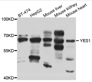 YES1 / c-Yes Antibody - Western blot analysis of extracts of various cell lines, using YES1 antibody at 1:1000 dilution. The secondary antibody used was an HRP Goat Anti-Rabbit IgG (H+L) at 1:10000 dilution. Lysates were loaded 25ug per lane and 3% nonfat dry milk in TBST was used for blocking. An ECL Kit was used for detection and the exposure time was 20s.