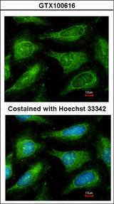 YES1 / c-Yes Antibody - Immunofluorescence of methanol-fixed HeLa, using c-Yes antibody at 1:200 dilution.