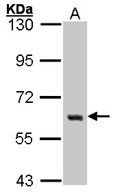 YES1 / c-Yes Antibody - Sample (30 ug of whole cell lysate). A: A431. 7.5% SDS PAGE. YES1 antibody diluted at 1:1000. 