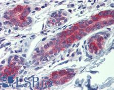 YES1 / c-Yes Antibody - Anti-YES1 antibody IHC of human breast. Immunohistochemistry of formalin-fixed, paraffin-embedded tissue after heat-induced antigen retrieval. Antibody concentration 10 ug/ml.