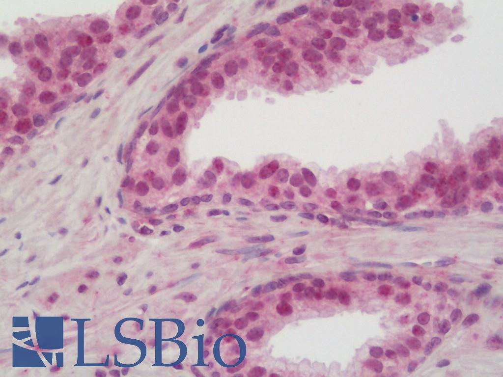 Yo / CDR2 Antibody - Human Prostate: Formalin-Fixed, Paraffin-Embedded (FFPE).  This image was taken for the unconjugated form of this product. Other forms have not been tested.