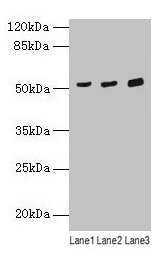 Yo / CDR2 Antibody - Western blot All lanes: CDR2 antibody at 4µg/ml Lane 1: Mouse lung tissue Lane 2: Hela whole cell lysate Lane 3: HepG2 whole cell lysate Secondary Goat polyclonal to rabbit IgG at 1/10000 dilution Predicted band size: 52 kDa Observed band size: 52 kDa