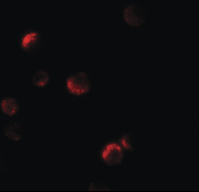 YPEL1 Antibody - Immunofluorescence of YPEL1 in HeLa cells with YPEL1 antibody at 20 ug/ml.