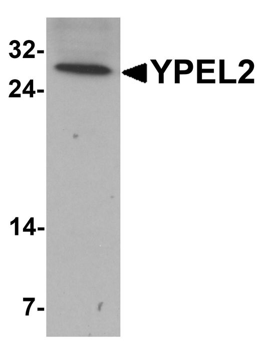YPEL2 Antibody - Western blot analysis of YPEL2 in HeLa cell lysate with YPEL2 antibody at 1 ug/ml.