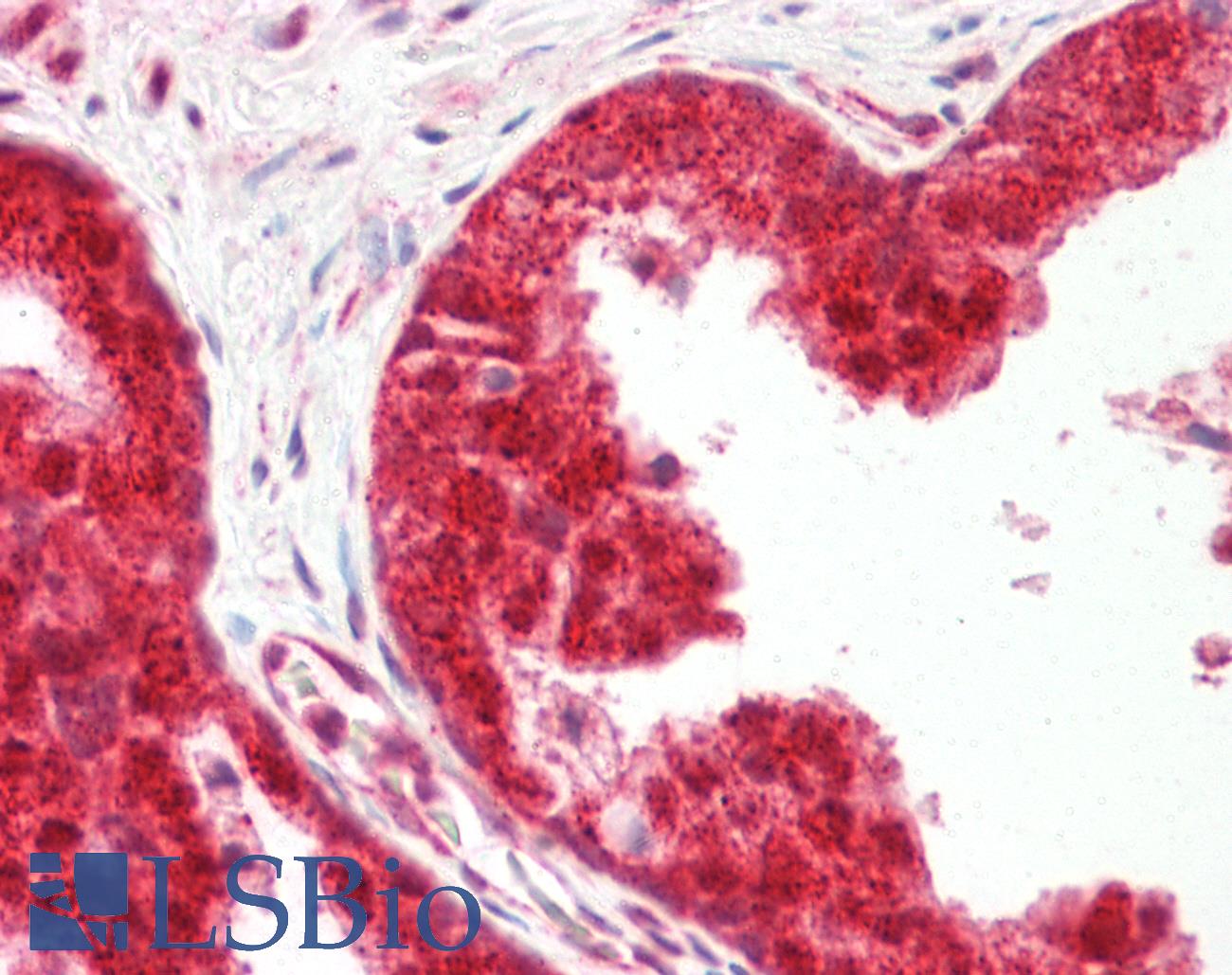 YPEL3 Antibody - Anti-YPEL3 antibody IHC staining of human prostate. Immunohistochemistry of formalin-fixed, paraffin-embedded tissue after heat-induced antigen retrieval.
