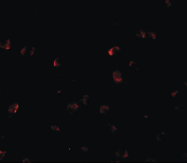 YPEL3 Antibody - Immunofluorescence of YPEL3 in A20 cells with YPEL3 antibody at 5 ug/ml.