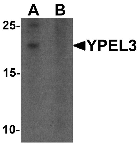 YPEL3 Antibody - Western blot analysis of YPEL3 in A-20 cell lysate with YPEL3 antibody at 1 ug/ml in (A) the absence and (B) the presence of blocking peptide