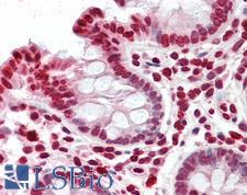 YPEL4 Antibody - Anti-YPEL4 antibody IHC staining of human colon. Immunohistochemistry of formalin-fixed, paraffin-embedded tissue after heat-induced antigen retrieval.