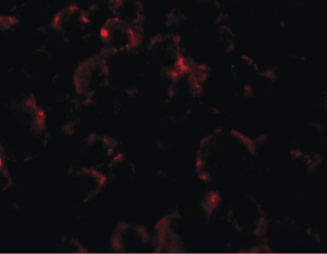 YPEL4 Antibody - Immunofluorescence of YPEL4 in SW480 cells with YPEL4 antibody at 5 ug/ml.
