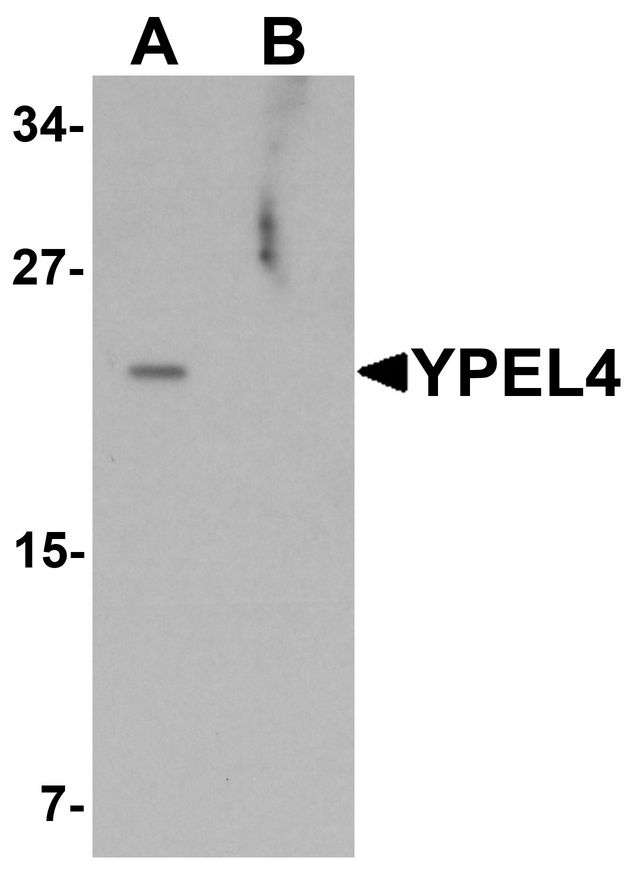 YPEL4 Antibody - Western blot analysis of YPEL4 in SW480 cell lysate with YPEL4 antibody at 1 ug/ml in (A) the absence and (B) the presence of blocking peptide.