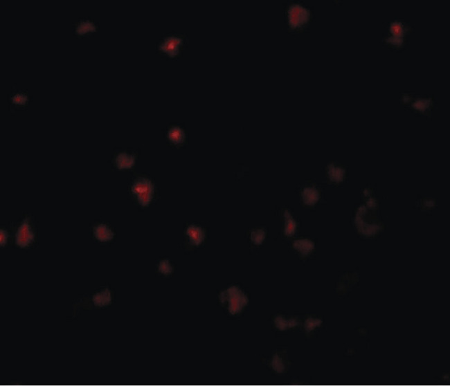 YPEL5 Antibody - Immunofluorescence of YPEL5 in A20 cells with YPEL5 antibody at 5 ug/ml.