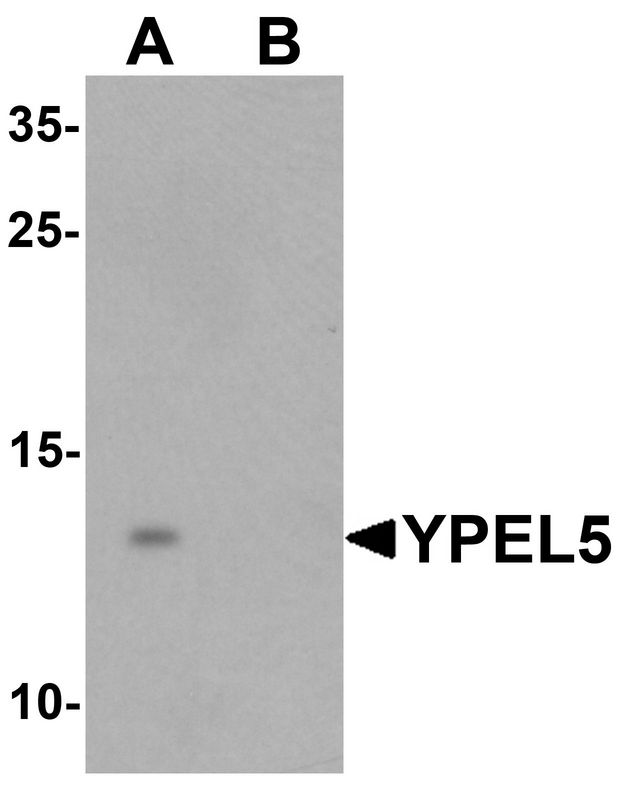 YPEL5 Antibody - Western blot analysis of YPEL5 in A-20 cell lysate with YPEL5 antibody at 1 ug/ml in (A) the absence and (B) the presence of blocking peptide.