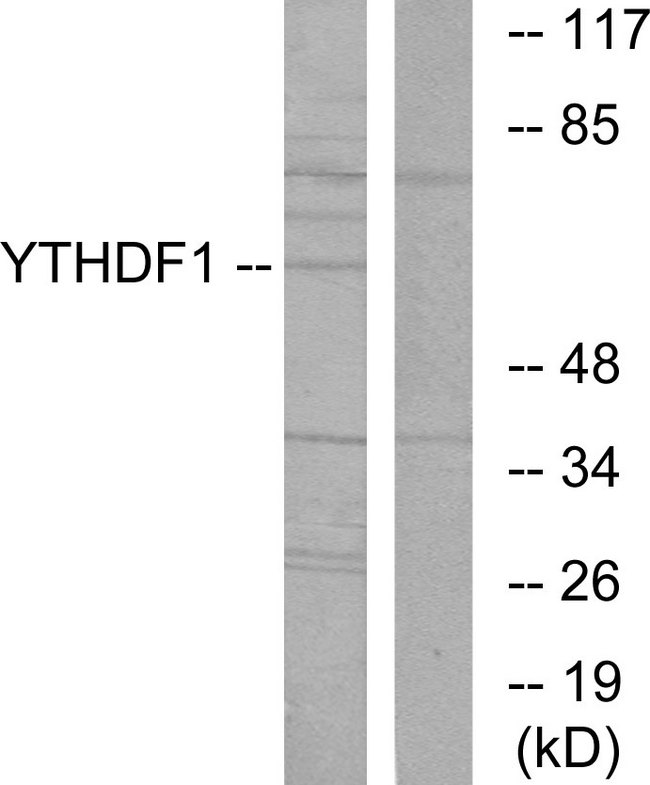 YTHDF1 Antibody - Western blot analysis of lysates from 293 cells, using YTHDF1 Antibody. The lane on the right is blocked with the synthesized peptide.