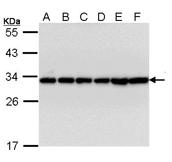 YWHAB / 14-3-3 Beta Antibody - Sample (30 ug of whole cell lysate). A: A431. B: H1299. C: Hela. D: Hep G2. E: Molt-4. F: Raji. 12% SDS PAGE. YWHAB antibody diluted at 1:10000. 