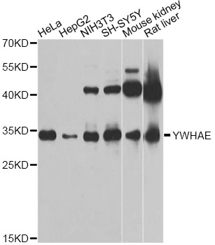 YWHAE / 14-3-3 Epsilon Antibody - Western blot analysis of extracts of various cell lines, using YWHAE antibody at 1:1000 dilution. The secondary antibody used was an HRP Goat Anti-Rabbit IgG (H+L) at 1:10000 dilution. Lysates were loaded 25ug per lane and 3% nonfat dry milk in TBST was used for blocking. An ECL Kit was used for detection and the exposure time was 5s.
