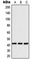 YWHAH / 14-3-3 Eta Antibody - Western blot analysis of 14-3-3 eta expression in MCF7 (A); SP2/0 (B); H9C2 (C) whole cell lysates.