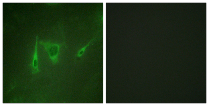YWHAZ / 14-3-3 Zeta Antibody - Immunofluorescence analysis of NIH/3T3 cells, using 14-3-3 zeta/delta Antibody. The picture on the right is blocked with the synthesized peptide.