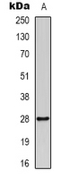 YWHAZ / 14-3-3 Zeta Antibody - Western blot analysis of 14-3-3-pan (AcK51/49) expression in mouse spleen (A) whole cell lysates.