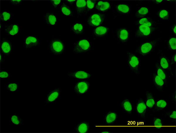 YY1 Antibody - Immunofluorescence of monoclonal antibody to YY1 on HeLa cell. [antibody concentration 10 ug/ml]