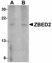 ZBED2 Antibody - Western blot of ZBED2 in A549 cell lysate with ZBED2 antibody at (A) 1 and (B) 2 ug/ml. 