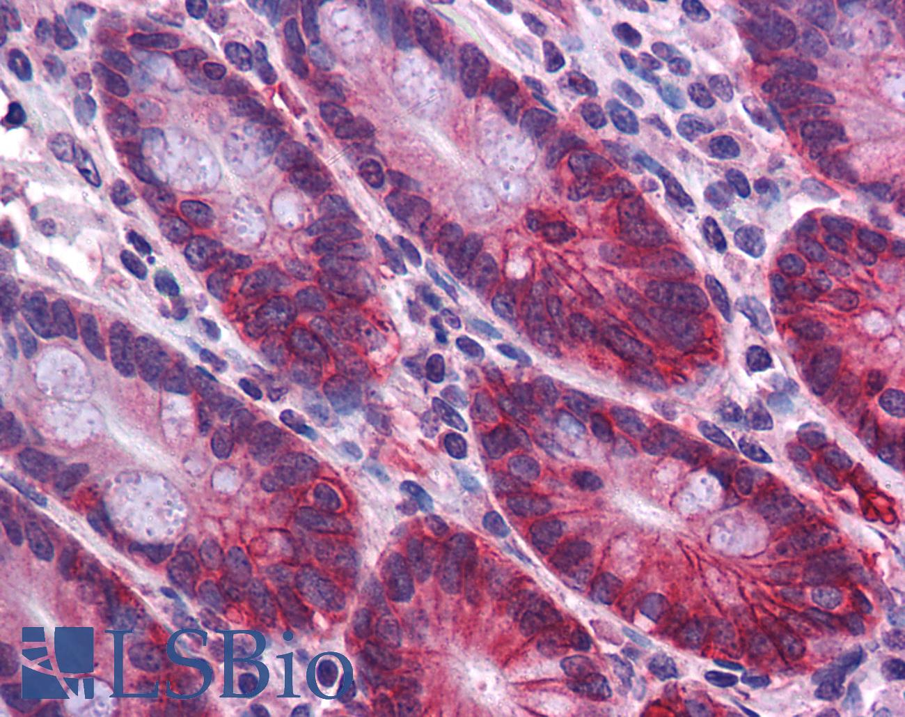 ZBED2 Antibody - Anti-ZBED2 antibody IHC of human small intestine. Immunohistochemistry of formalin-fixed, paraffin-embedded tissue after heat-induced antigen retrieval. Antibody concentration 5 ug/ml.