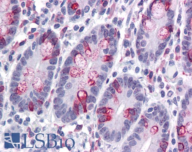 ZBED3 Antibody - Anti-ZBED3 antibody IHC of human small intestine. Immunohistochemistry of formalin-fixed, paraffin-embedded tissue after heat-induced antigen retrieval. Antibody concentration 5 ug/ml.