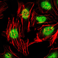 ZBTB16 / PLZF Antibody - Immunofluorescence of HeLa cells using ZBTB16 mouse monoclonal antibody (green). Red: Actin filaments have been labeled with Alexa Fluor-555 phalloidin.
