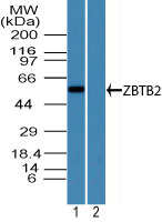 ZBTB2 Antibody - Western blot of ZBTB2 in human brain lysate in the 1) absence and 2) presence of immunizing peptide using ZBTB2 Antibody at3 ug/ml. Goat anti-rabbit Ig HRP secondary antibody, and PicoTect ECL substrate solution, were used for this test.