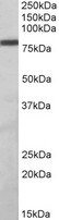 ZBTB24 / BIF1 Antibody - ZBTB24 antibody (1 ug/ml) staining of Daudi lysate (35 ug protein in RIPA buffer). Primary incubation was 1 hour. Detected by chemiluminescence.