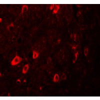 ZBTB3 Antibody - Immunofluorescence of ZBTB3 in human brain tissue with ZBTB3 antibody at 20 µg/mL.