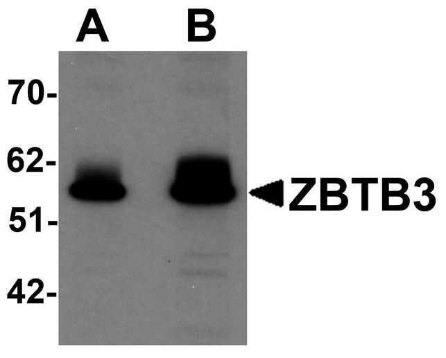 ZBTB3 Antibody - Western blot analysis of ZBTB3 in rat brain tissue lysate with ZBTB3 antibody at (A) 1 and (B) 2 ug/ml.
