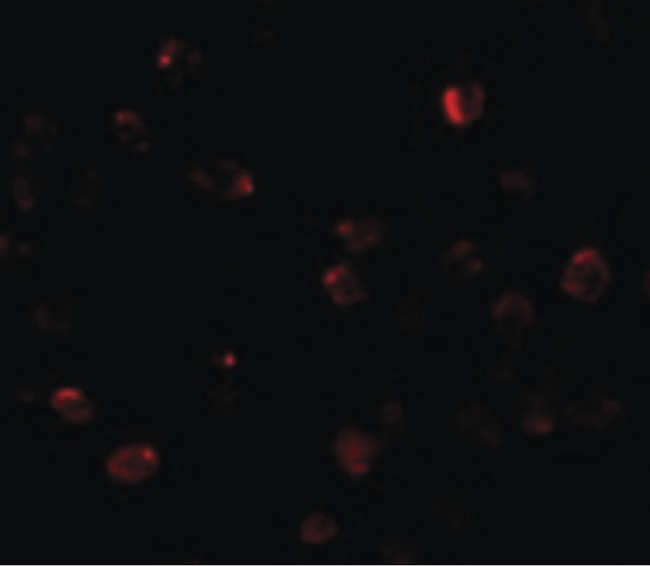 ZBTB40 Antibody - Immunofluorescence of ZBTB40 in Raji cells with ZBTB40 antibody at 20 ug/ml.