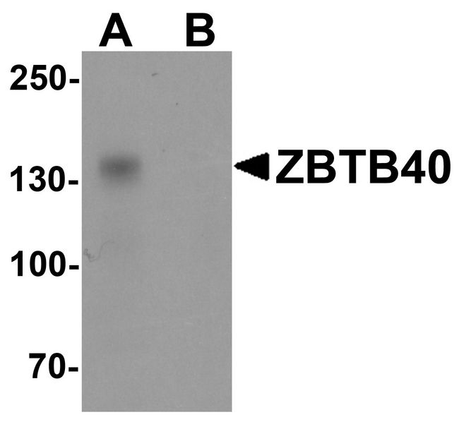 ZBTB40 Antibody - Western blot analysis of ZBTB40 in Raji cell lysate with ZBTB40 antibody at 0.5 ug/ml in (A) the absence and (B) the presence of blocking peptide.