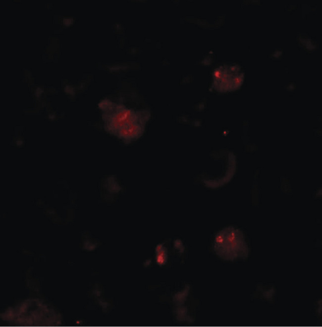 ZBTB6 Antibody - Immunofluorescence of ZBTB6 in EL4 cells with ZBTB6 antibody at 20 ug/ml.