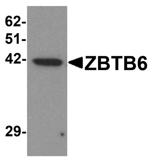 ZBTB6 Antibody - Western blot analysis of ZBTB6 in EL4 cell lysate with ZBTB6 antibody at 1 ug/ml.