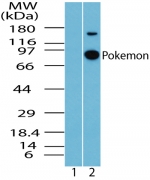 ZBTB7A / Pokemon Antibody - Western blot of ZBTB7A/Pokemon in MCF7 cell lysate. Lane 1 shows pre-immune sera and lane 2 shows antibody tested on MCF7 at 1:1000 dilution.