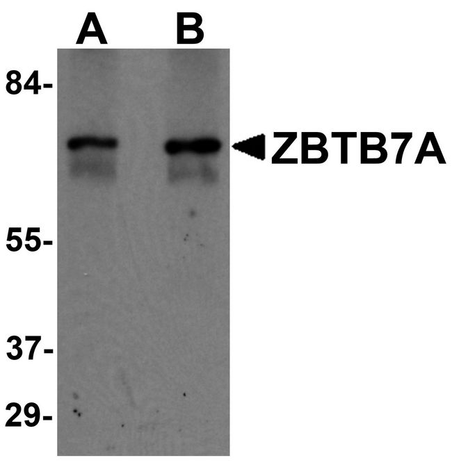 ZBTB7A / Pokemon Antibody - Western blot analysis of ZBTB7A in human ovary tissue lysate with ZBTB7A antibody at (A) 1 and (B) 2 ug/ml.