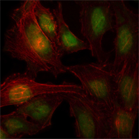 ZBTB7B / HcKrox Antibody - Immunofluorescence of HeLa cells using ZBTB7B mouse monoclonal antibody (green). Red: Actin filaments have been labeled with Alexa Fluor-555 phalloidin