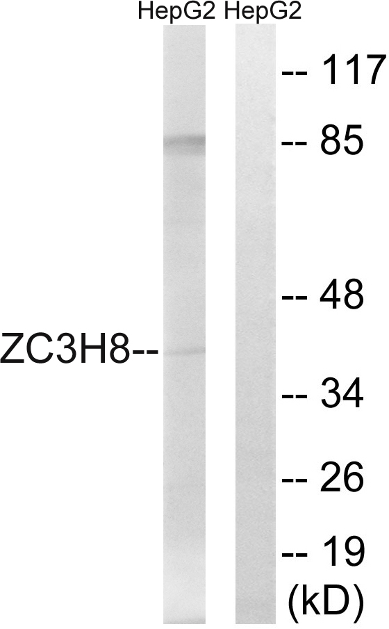ZC3H8 Antibody - Western blot analysis of lysates from HepG2 cells, using ZC3H8 Antibody. The lane on the right is blocked with the synthesized peptide.