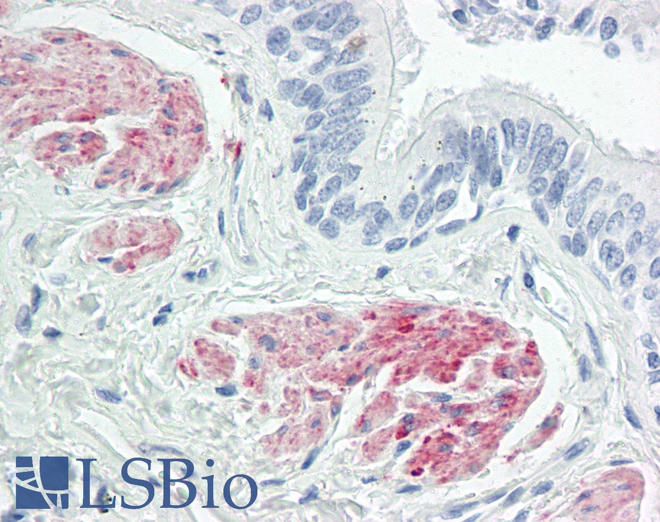 ZC3H8 Antibody - Anti-ZC3H8 antibody IHC of human lung, smooth muscle. Immunohistochemistry of formalin-fixed, paraffin-embedded tissue after heat-induced antigen retrieval. Antibody dilution 5 ug/ml.
