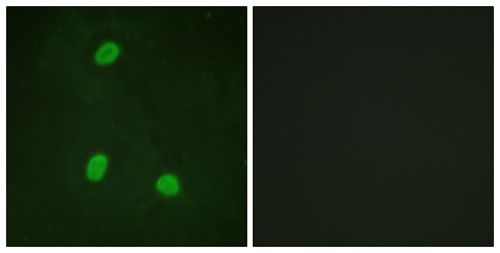 ZC3HC1 / NIPA Antibody - Immunofluorescence analysis of HeLa cells, using NIPA Antibody. The picture on the right is blocked with the synthesized peptide.