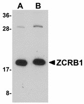 ZCRB1 Antibody - Western blot of ZCRB1 in Raji cell lysate with ZCRB1 antibody at (A) 1 and (B) 2 ug/ml.