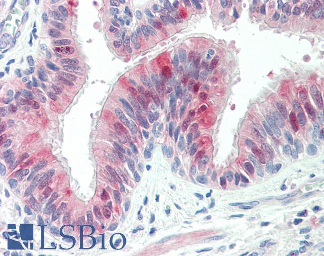 ZDHHC13 / HIP14L Antibody - Anti-ZDHHC13 / HIP14L antibody IHC staining of human lung, respiratory epithelium. Immunohistochemistry of formalin-fixed, paraffin-embedded tissue after heat-induced antigen retrieval. Antibody concentration 5 ug/ml.