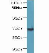 ZDHHC3 Antibody - Western blot. All lanes: ZDHHC3 antibody at 1.5 ug/ml+ Mouse brain tissue Goat polyclonal to rabbit at 1:10000 dilution. Predicted band size: 34 kDa. Observed band size: 34 kDa.