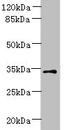 ZDHHC3 Antibody - Western blot All lanes: ZDHHC3 antibody at 1.5µg/ml + Mouse brain tissue Secondary Goat polyclonal to rabbit IgG at 1/10000 dilution Predicted band size: 35, 38 kDa Observed band size: 35 kDa